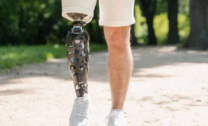 پای مصنوعی هوشمند