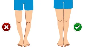 کفش مخصوص پای پرانتزی