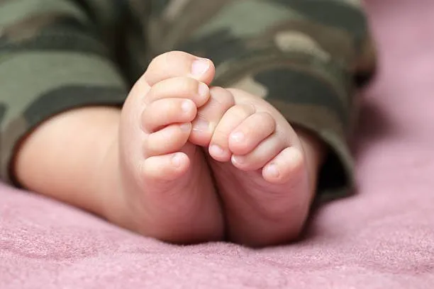انحراف انگشتان پا در کودکان