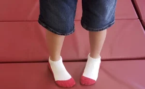 انحراف پنجه پا به داخل