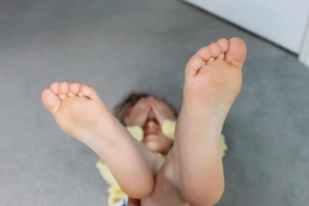 انحراف پاشنه