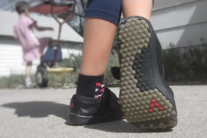 تاثیر کفش طبی بر رشد استخوانی کودکان