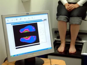 اسکن سه بعدی کف پا